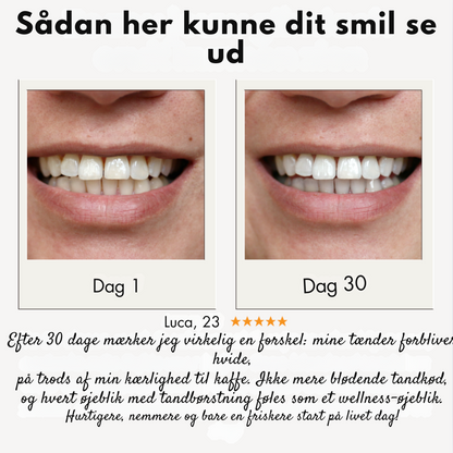 BørstTænder | Strålende tænder på få sekunder
