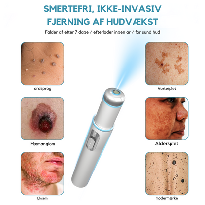 FläckBort | Fjerner effektivt hudproblemer!