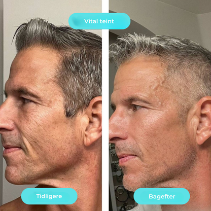 KøleBowl | Det virale Ice Glow til din morgenrutine