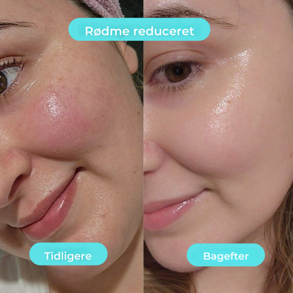 KøleBowl | Det virale Ice Glow til din morgenrutine