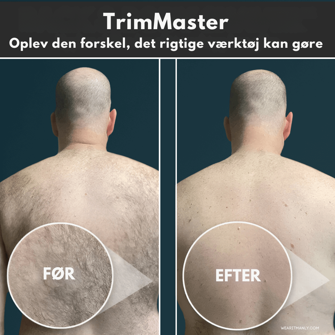 TrimMaster | Ryg & Body Shaver