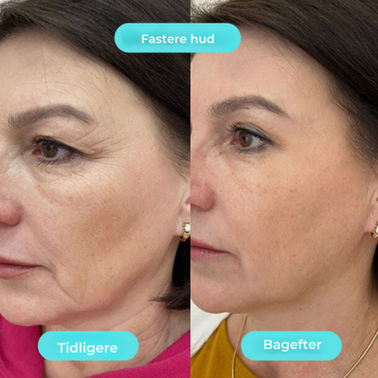 KøleBowl | Det virale Ice Glow til din morgenrutine